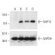 Cholecalciferol: sc-205630. Western blot analysis of DAP12 expression in untreated (A), PMA treated (B), Cholecalciferol t 