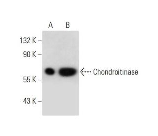 Chondroitinase Antibody (G-4) - Western Blotting - Image 289570 