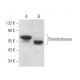 Chondroitinase Antibody (G-4) - Western Blotting - Image 373246
