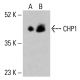 Anticuerpo CHP1 (B-10): sc-390835. Análisis por Western blot de la expresión de CHP1 en lisados celulares completos de HeLa (A) y HCT-116 (B). Reactivo de detección utilizado: m-IgG Fc BP-HRP: sc-525409. CHP1 Antibody (B-10) - Western Blotting - Image 415164