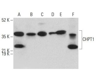 CHPT1 Antibody (F-7) - Western Blotting - Image 379026 