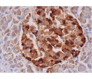 Chr-A Antibody (PHE5) - Immunohistochemistry - Image 289447