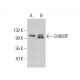 western blotting image from recommended ChREBP (G-12) monoclonal antibody replacement. Image 377907