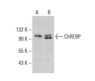 western blotting image from recommended ChREBP (G-12) monoclonal antibody replacement. Image 377907
