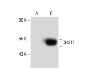 CHST1 Antibody (E-3) - Western Blotting - Image 134769