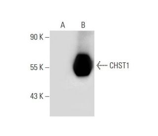 CHST1 Antibody (E-8) - Western Blotting - Image 139550