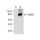 CHSY2 Antibody (E-5) - Western Blotting - Image 154521