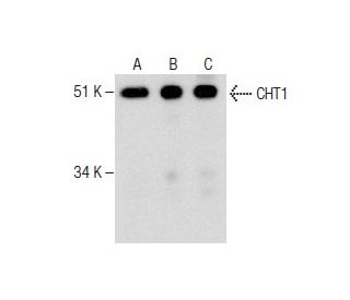 CHT1 Antibody (62-2ES) - Western Blotting - Image 282629 