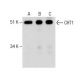 CHT1 Antibody (62-2ES) - Western Blotting - Image 282629 