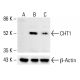 CHT1 Antibody (62-2ES) - Western Blotting - Image 412542