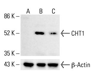 CHT1 Antibody (62-2ES) - Western Blotting - Image 412542