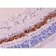 immunohistochemistry image from recommended Chx10 (E-12) monoclonal antibody replacement. Image 369571