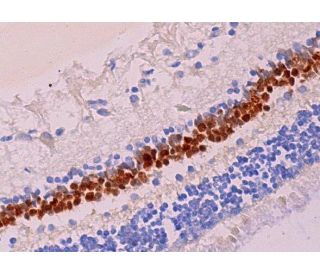 immunohistochemistry image from recommended Chx10 (E-12) monoclonal antibody replacement. Image 369571