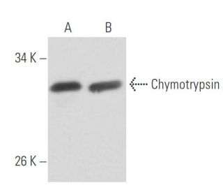 Chymotrypsin Antibody (602) - Western Blotting - Image 15776Each CRISPR/Cas9 Knockout (KO) Plasmid product consists of a pool of 3 plasmids designed to ensure identification and cleavage of a specific gene for maximum knockout efficiency. Each plasmid encodes a unique 20 nt sequence derived from the GeCKO (v2) library.