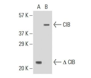 CIB Antibody (5A1H7E12) - Western Blotting - Image 137429