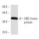 CIB2 Antibody (CIB2C12B11) - Western Blotting - Image 16915