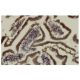 CIDE-B Antibody (5X) - Immunohistochemistry - Image 36353