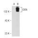 CIITA (7-1H): sc-13556. Western blot analysis of CIITA expression in non-transfected: sc-117752 (A) and mouse CIITA transf 