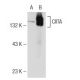 CIITA (7-1H): sc-13556. Western blot analysis of CIITA expression in non-transfected: sc-117752 (A) and mouse CIITA transf