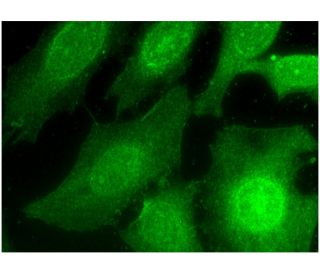 CIN85 Antibody (E-1) - Immunofluorescence - Image 296784 