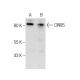Este anticuerpo policlonal ha dejado de fabricarse. Consulta nuestro anticuerpo monoclonal recomendado <a href="cin85-antibody-a-7">CIN85 (A-7)</a> (se muestran datos de muestra). western blotting image from recommended CIN85 (A-7) monoclonal antibody replacement. Image 283619