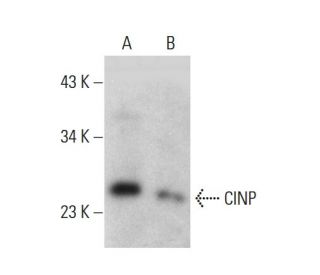CINP Antibody (AT1G10) - Western Blotting - Image 385116