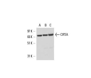 CIP2A Antibody (HL1925) - Western Blotting - Image 17311 