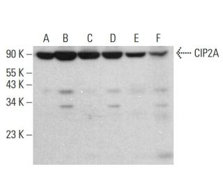 CIP2A Antibody (4A9-1A2) - Western Blotting - Image 380348