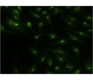 CIRP Antibody (1C9) - Immunofluorescence - Image 346113 