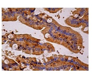 CIS Antibody (D-8) - Immunohistochemistry - Image 159071 