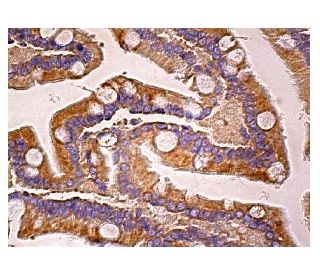 immunohistochemistry image from recommended CIS (F-9) monoclonal antibody replacement. Image 158895