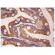 immunohistochemistry image from recommended CIS (F-9) monoclonal antibody replacement. Image 158895