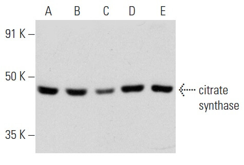ベース catalyst Integrin β3/ITGB3/CD61 Antibody (F-11) | SCBT - Santa Cruz