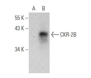 CKR-2B Antibody (D-6) - Western Blotting - Image 364915 