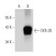 CKR-2B Antibody (A-11) - Western Blotting - Image 364949
