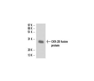 western blotting image from recommended CKR-2B (A-11) monoclonal antibody replacement. Image 16313