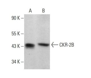 CKR-2B Antibody (D-6) - Western Blotting - Image 381342 