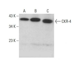 CKR-4 Antibody (KH-4F5) - Western Blotting - Image 377992 