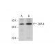 CKR-4 Antibody (KH-4F5) - Western Blotting - Image 384355 