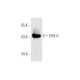 western blotting image from recommended CKR-5 (D-6) monoclonal antibody replacement. Image 66884