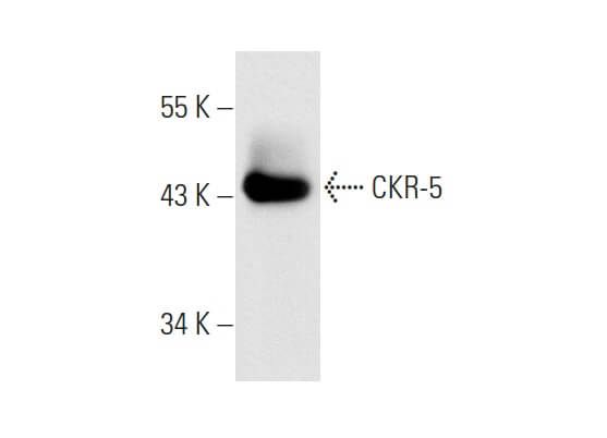CKR-5 Antibody (D-6) | SCBT - Santa Cruz Biotechnology