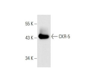 western blotting image from recommended CKR-5 (D-6) monoclonal antibody replacement. Image 66884