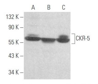 CKR-5 Antibody (R-C10) - Western Blotting - Image 356120 