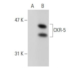 CKR-5 Antibody (T21/8) - Western Blotting - Image 38957