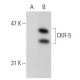 CKR-5 Antibody (T21/8) - Western Blotting - Image 38957