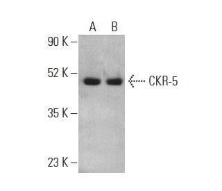 CKR-5 Antibody (D-6) - Western Blotting - Image 400710