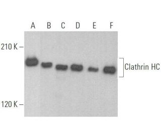 western blotting image from recommended Clathrin Heavy Chain/CLTC (TD.1) monoclonal antibody replacement. Image 353302
