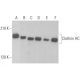 western blotting image from recommended Clathrin Heavy Chain/CLTC (TD.1) monoclonal antibody replacement. Image 353302