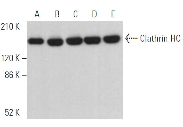 Clathrin Heavy Chain/CLTC Antibody (TD.1) | SCBT - Santa