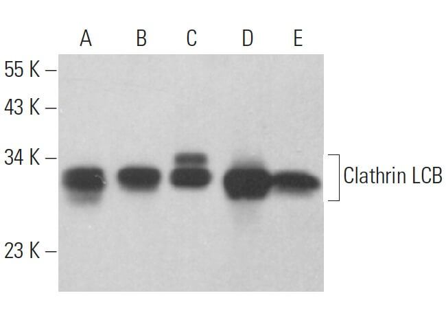 Clathrin Light Chain B/CLTB CRISPR/Cas9 KO Plasmid (h) | SCBT - Santa ...